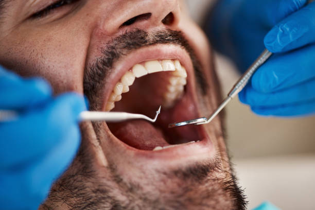 Best Emergency Gum Pain Relief  in Yermo, CA